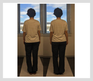 姿勢改善&リンパ